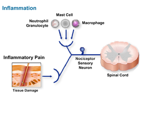 Learn the chemical mediators that are released from damaged cells as a result of tissue damage and the inflammatory mediators that activate and sensitize the pain pathways.